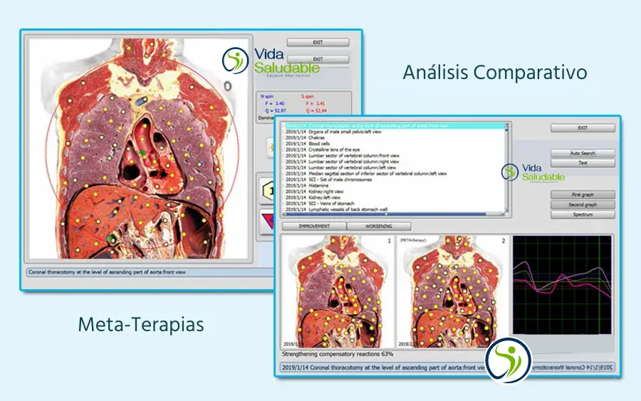 Meta Terapias Bioplasm 10 D